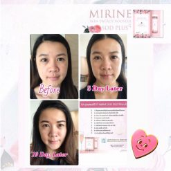 MIRINE SOD PLUS