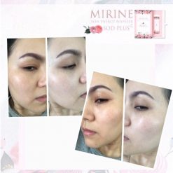 MIRINE SOD PLUS