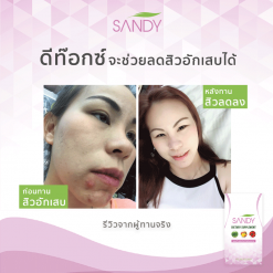 Sandy Detox