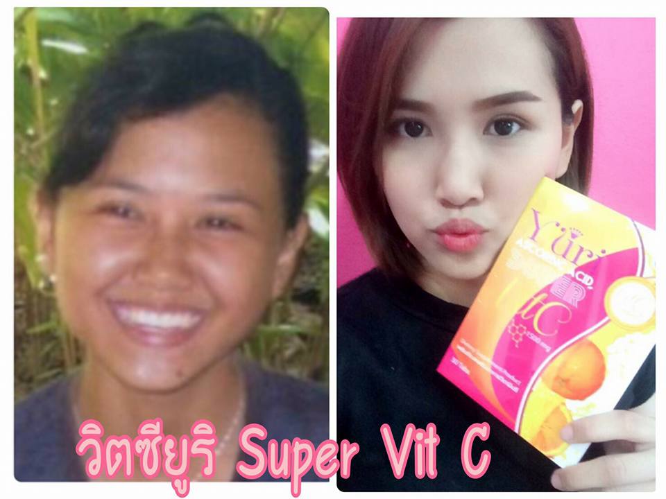 Yuri Ascorbic Acid Super Vit C