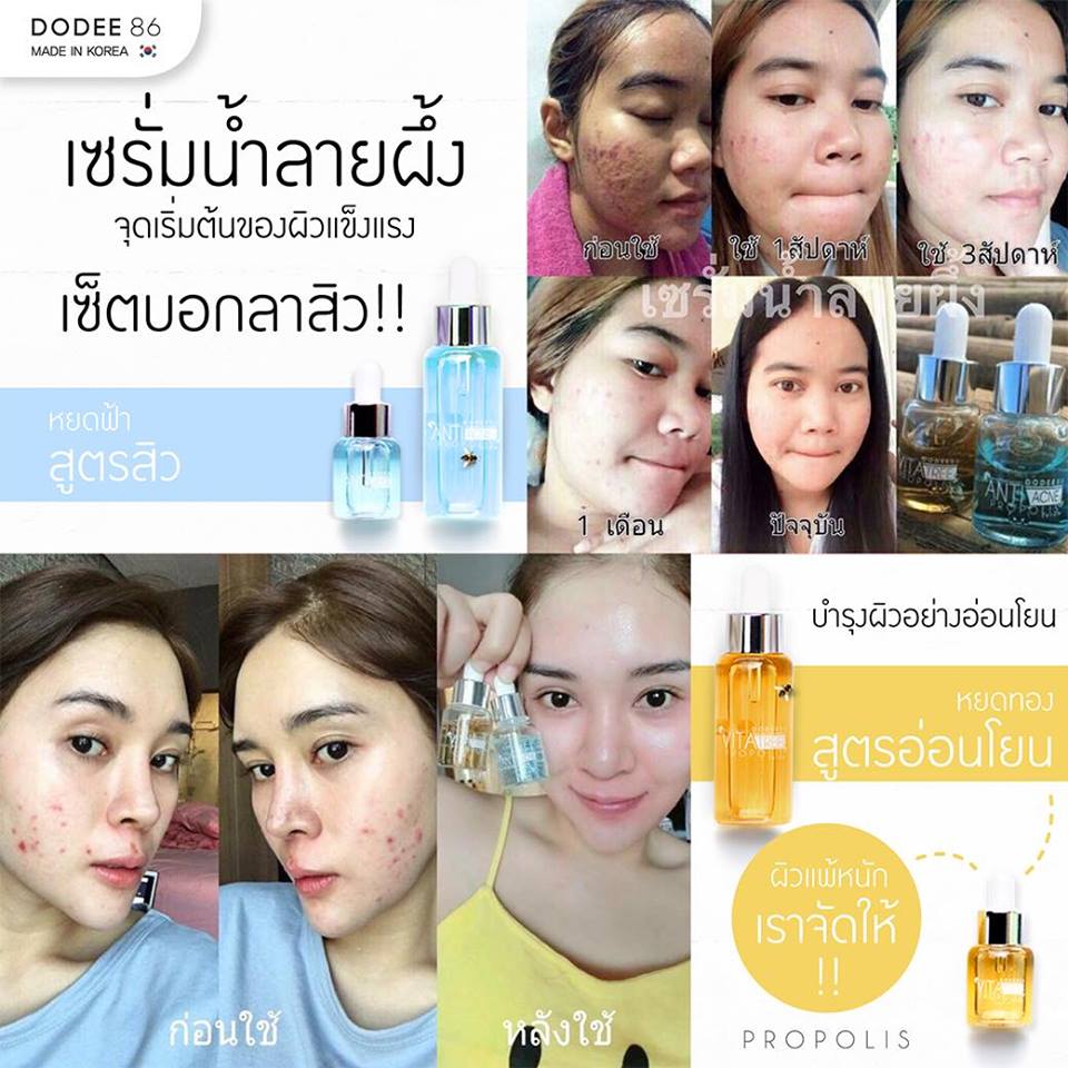 Anti Acne & Propolis Serum