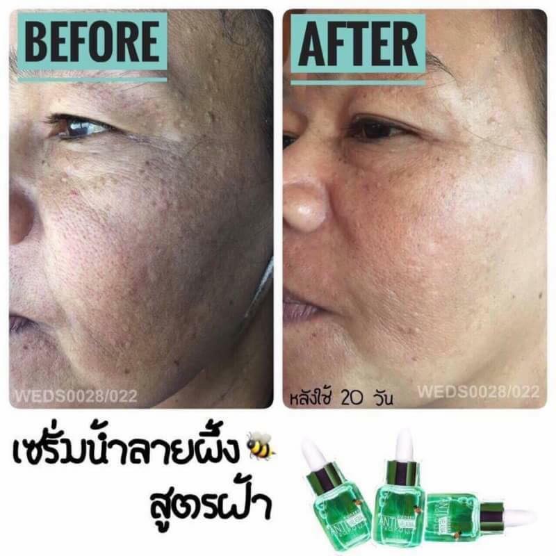 Anti Melasma & Propolis Serum