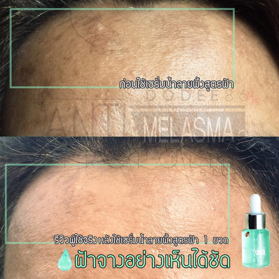 Anti Melasma & Propolis Serum