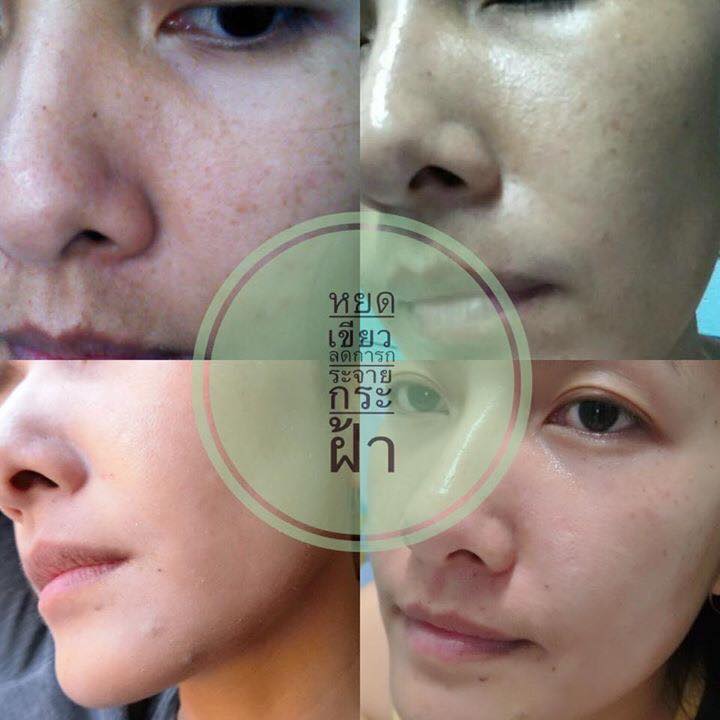 Anti Melasma & Propolis Serum