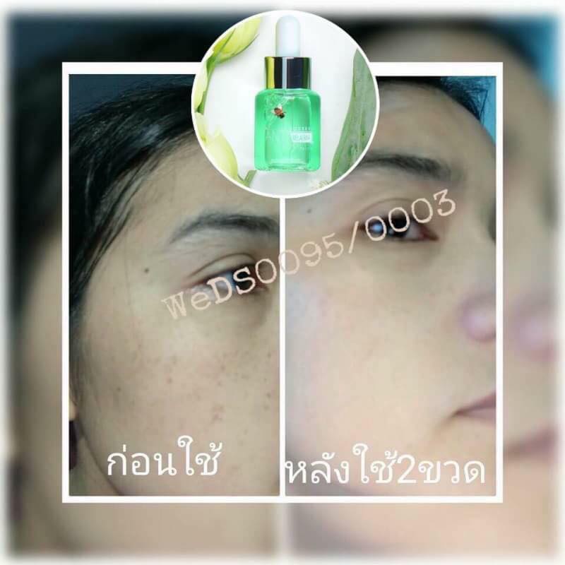 Anti Melasma & Propolis Serum