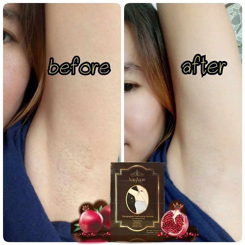 Nangngam Underarm Serum