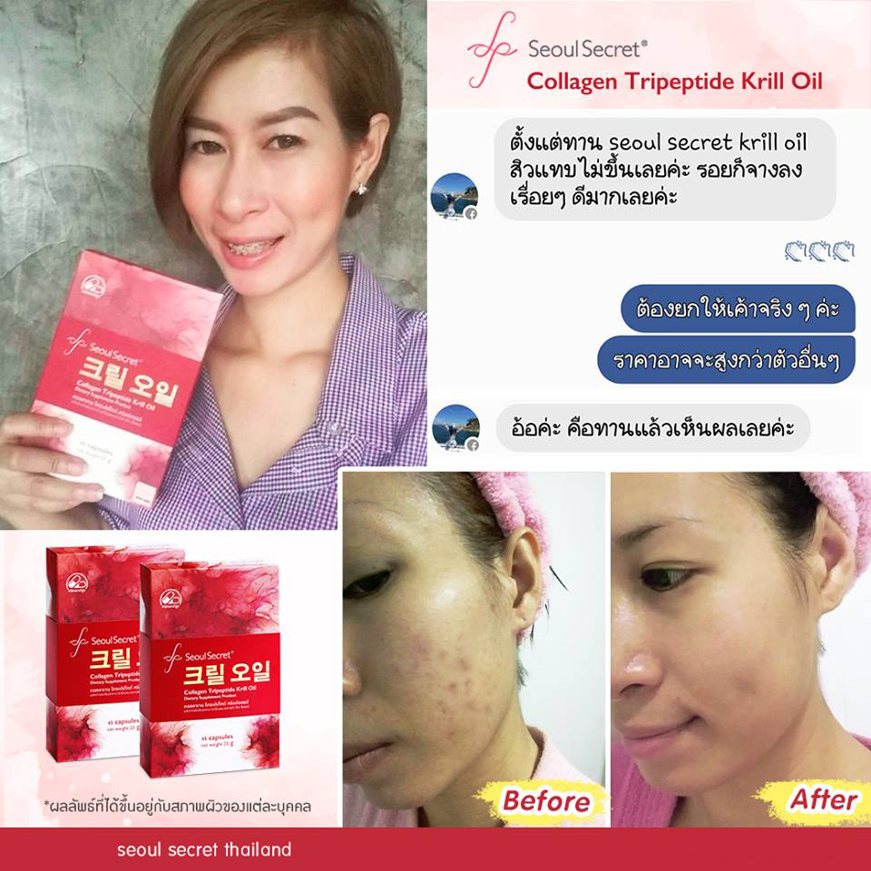 Seoul Secret Collagen Tripeptide Krill Oil