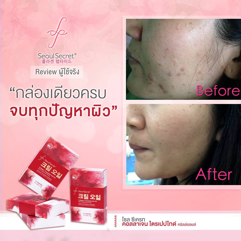 Seoul Secret Collagen Tripeptide Krill Oil