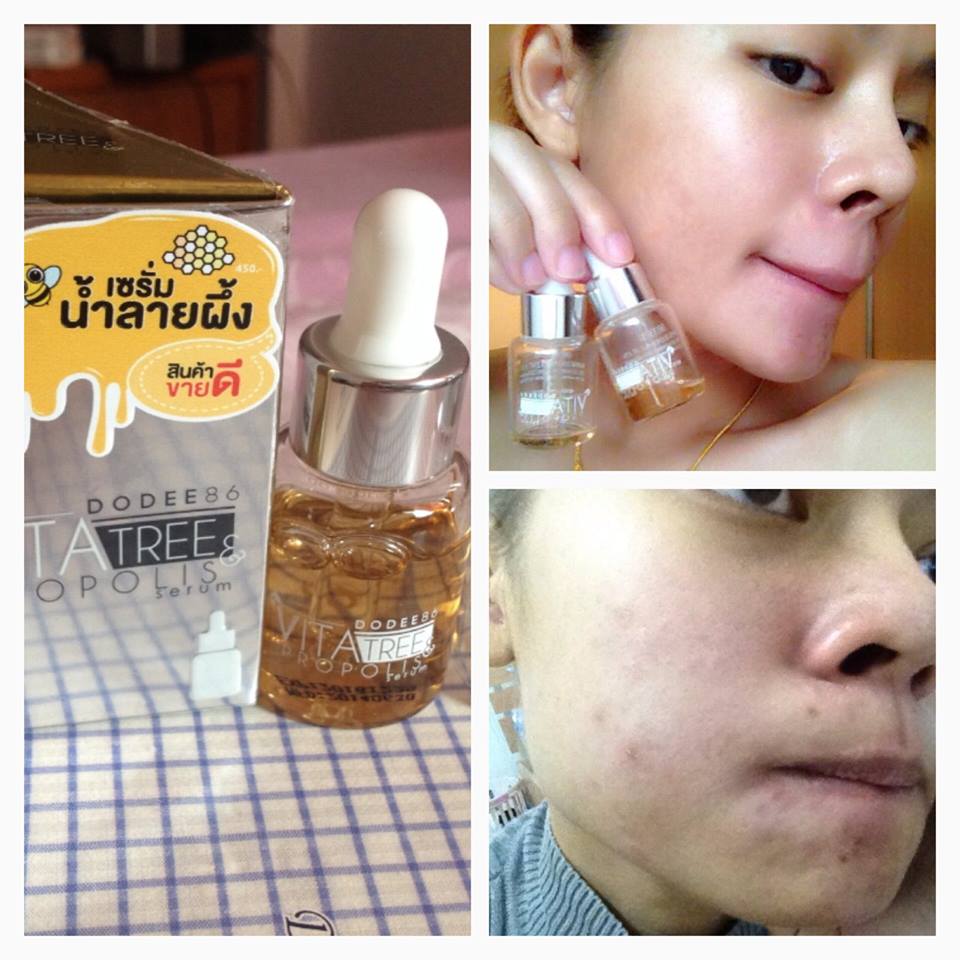 Vita Tree & Propolis Serum