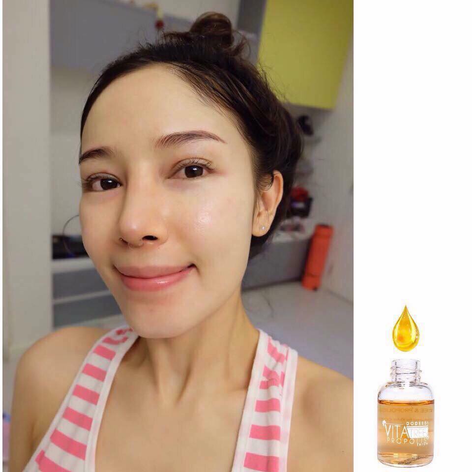 Vita Tree & Propolis Serum