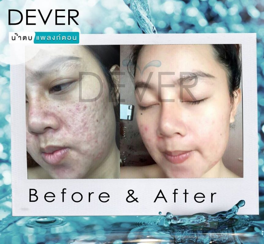 Dever Aqua Serum Fresh Plankton