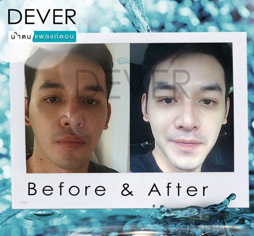 Dever Aqua Serum Fresh Plankton