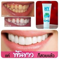 Hydent by Hylife