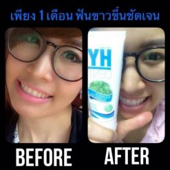 Hydent by Hylife