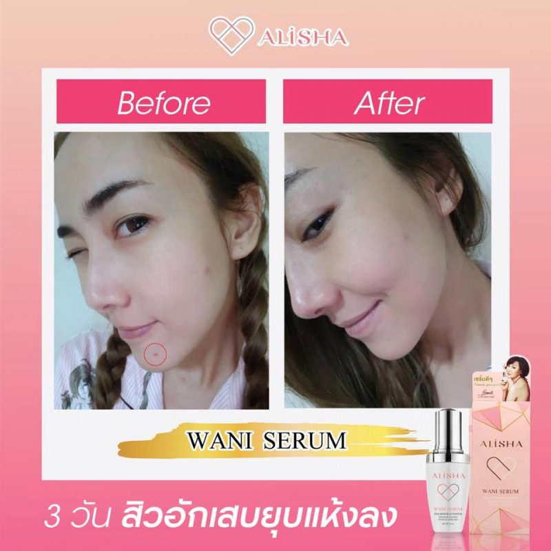 Alisha Wani Serum Dna Repair Activator