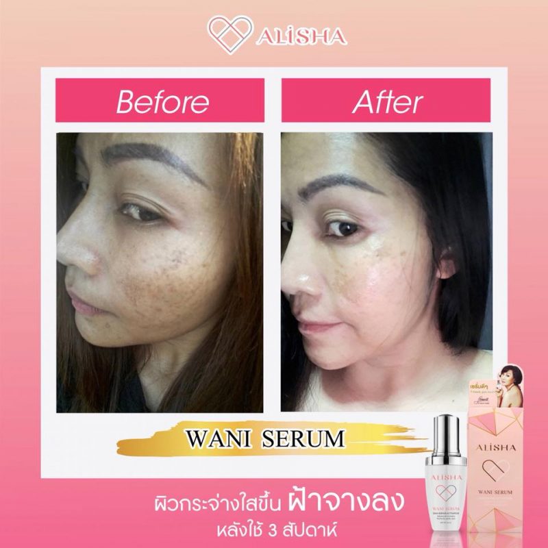 Alisha Wani Serum Dna Repair Activator