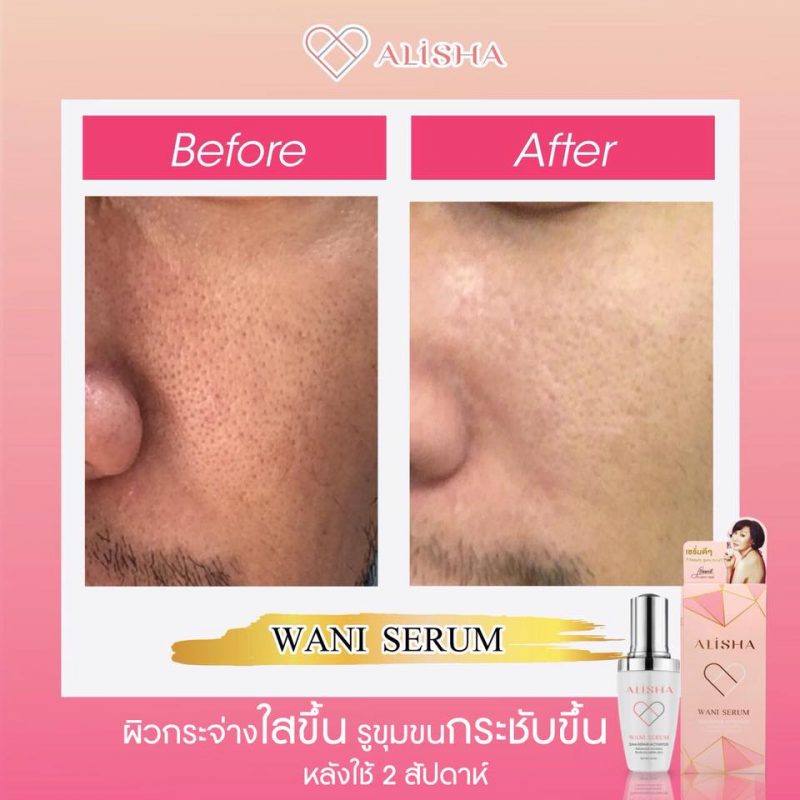 Alisha Wani Serum Dna Repair Activator