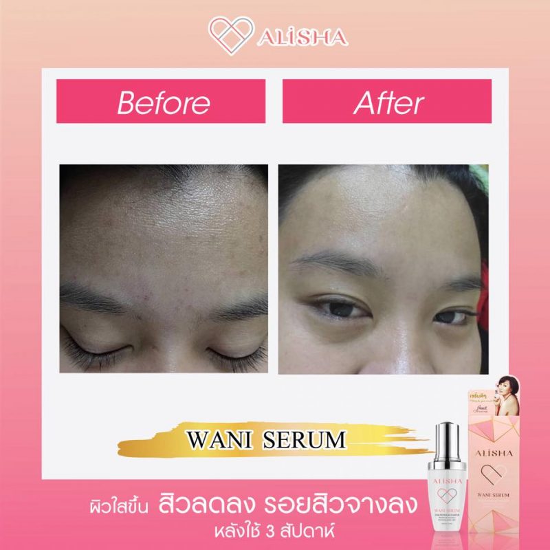 Alisha Wani Serum Dna Repair Activator