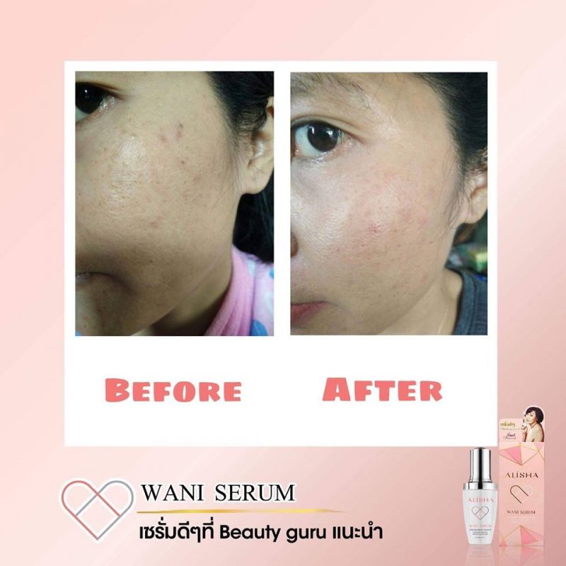 Alisha Wani Serum Dna Repair Activator