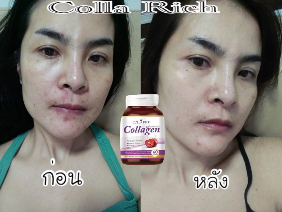 Colla Rich Collagen