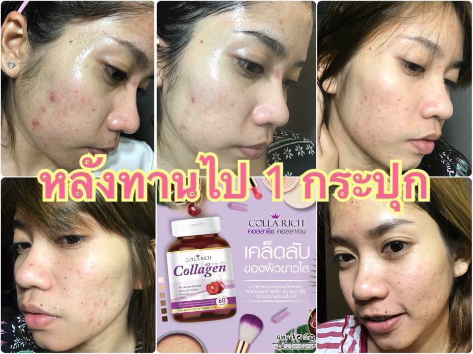 Colla Rich Collagen