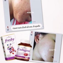 Colla Rich Freshy Mix Berry