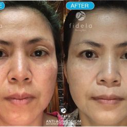 Fidela Anti-Aging Serum