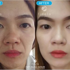 Fidela Anti-Aging Serum