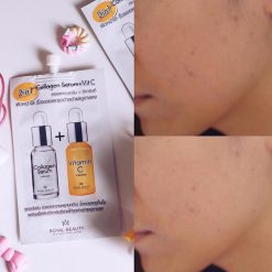 Royal Beauty Collagen Serum + Vit C