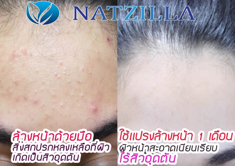 Natzilla Mineral Facial Gel