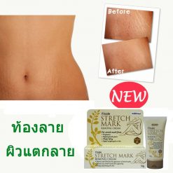 Finale Stretch Mark Removal Cream