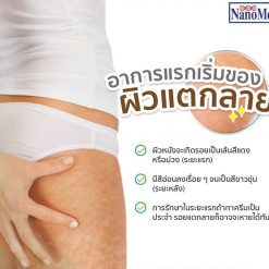 Finale Stretch Mark Removal Cream