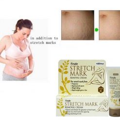 Finale Stretch Mark Removal Cream