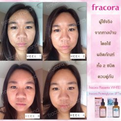 Fracora Lift’est Proteoglycan Serum
