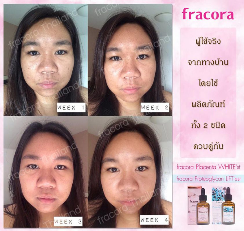 Fracora Lift’est Proteoglycan Serum