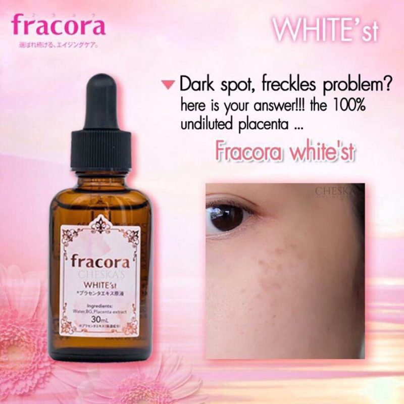 fracora WHITE'st プラセンタエッセンス 5本セット 30ml fracora WHITE'st プラセンタエッセンス 30ml 5本セット