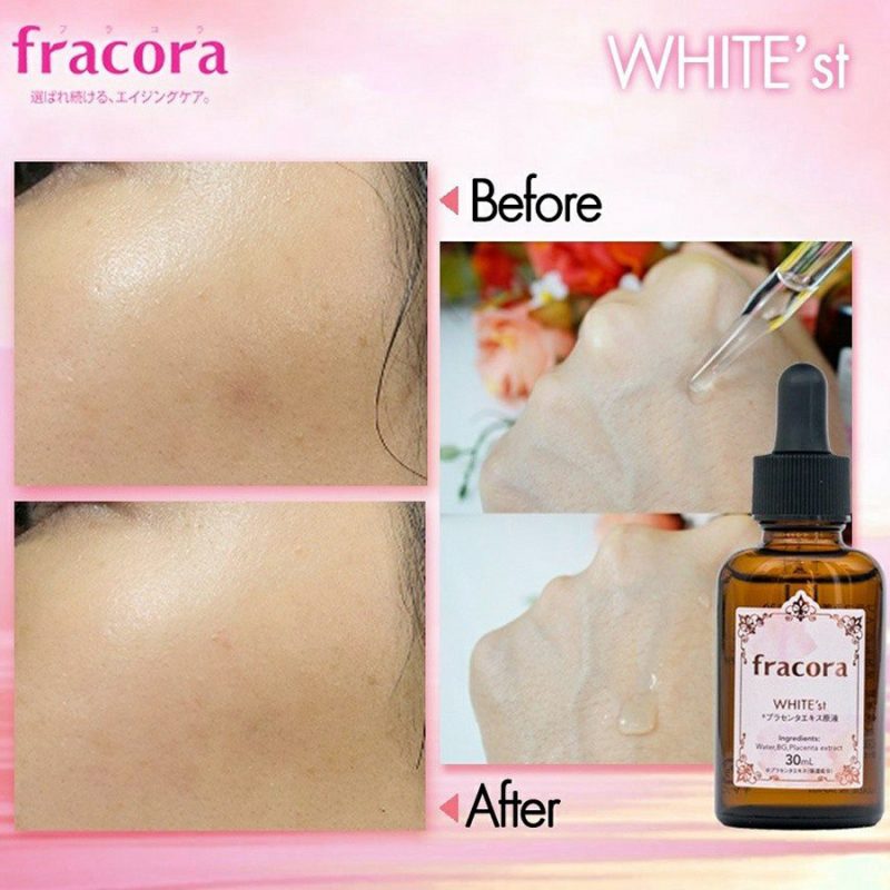 Fracora Placenta Extract Serum WHITE'st