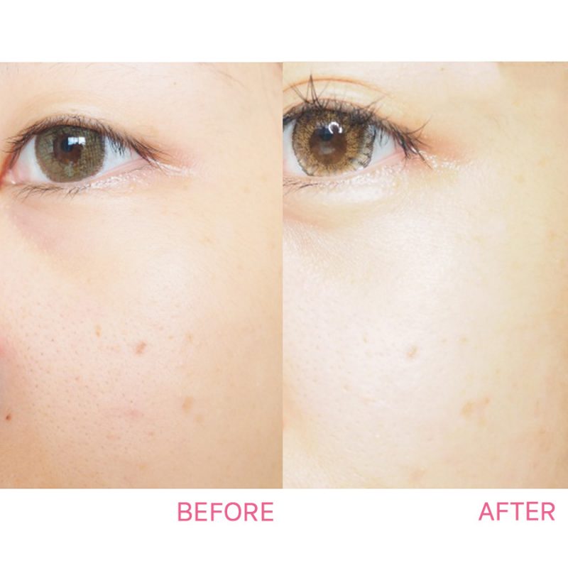 Fracora Placenta Lift Cream