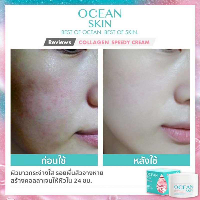 Ocean Skin Collagen Speedy Cream