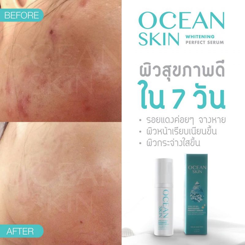 Ocean Skin Whitening Perfect Serum