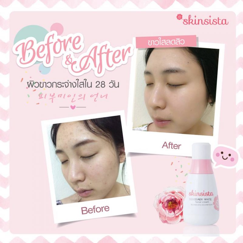 Skinsista Dongbaek White Facial Cream