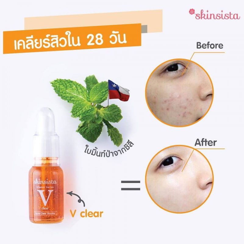 Skinsista V Clear Acne Clear Booster