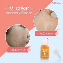 Skinsista V Clear Acne Clear Booster