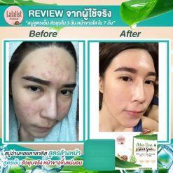 Aloe-Vera & Snail Gluta Whitening Soap