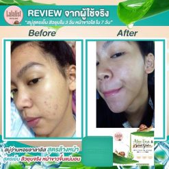 Aloe-Vera & Snail Gluta Whitening Soap