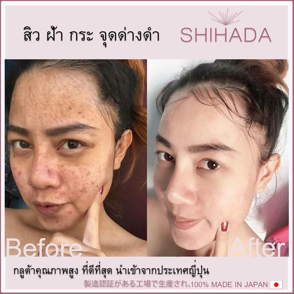 Gluta Shihada