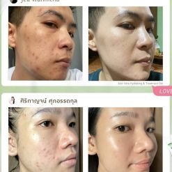 EVES Aloe Vera Hydrating & Treatment Gel Reviews