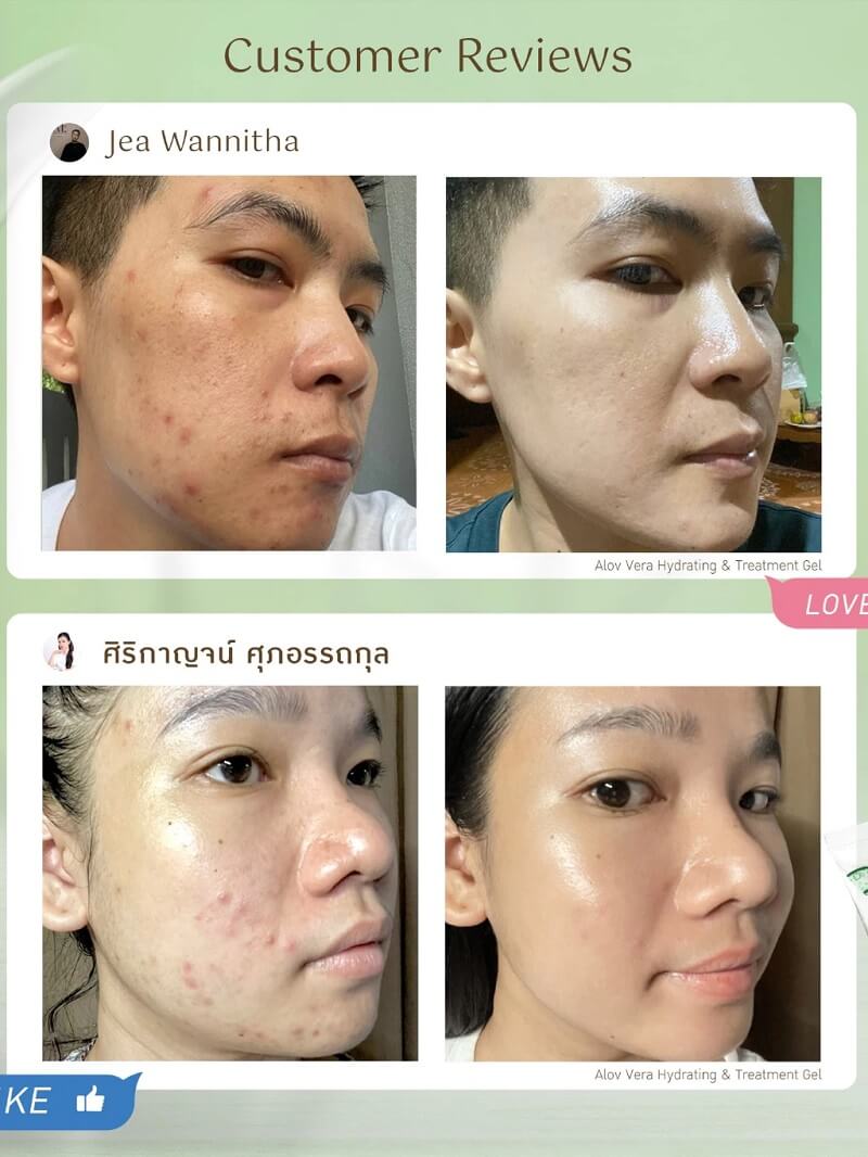 EVES Aloe Vera Hydrating & Treatment Gel Reviews