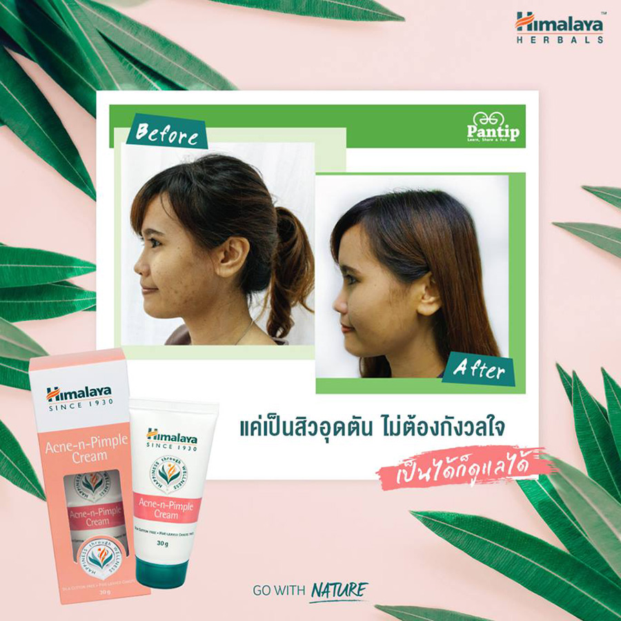 Himalaya Herbals Acne-n-Pimple Cream