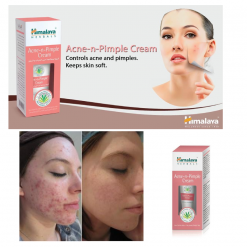 Himalaya Herbals Acne-n-Pimple Cream